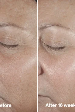 Outlet Smart Clinical Repair Seerumi 30 ml Hajusteettomat Ihonhoidon Tuotteet|Kasvojenhoito