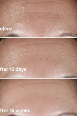 Outlet Smart Clinical Repair Seerumi 30 ml Hajusteettomat Ihonhoidon Tuotteet|Kasvojenhoito