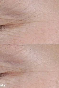 Smart Clinical Repair AM/PM Retinoid Balm täsmähoitotuote 3 g Ihonhoidon Tehoaineet|Kasvojenhoito