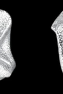 Clearance Fylgia-korvakorut hopea Korut