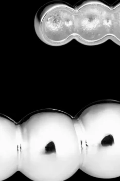 Lumoava Korut<Bonbon rannerengas