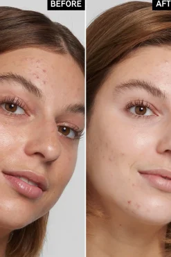 Best Salicylic Acid Cleanser puhdistusaine 150 ml Kasvojenhoito