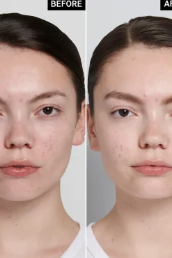 Hot Succinic Acid Treatment hoitovoide 15 ml Kasvojenhoito