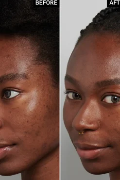 New Tranexamic Acid Serum 30 ml Kasvojenhoito