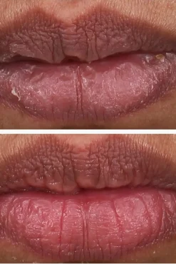 The Ordinary Kasvojenhoito<PHA 5% Exfoliating Lip Serum huuliseerumi 15 ml