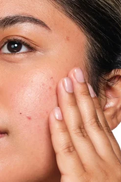 New Salicylic Acid 2% Solution liuos 30 ml Kasvojenhoito