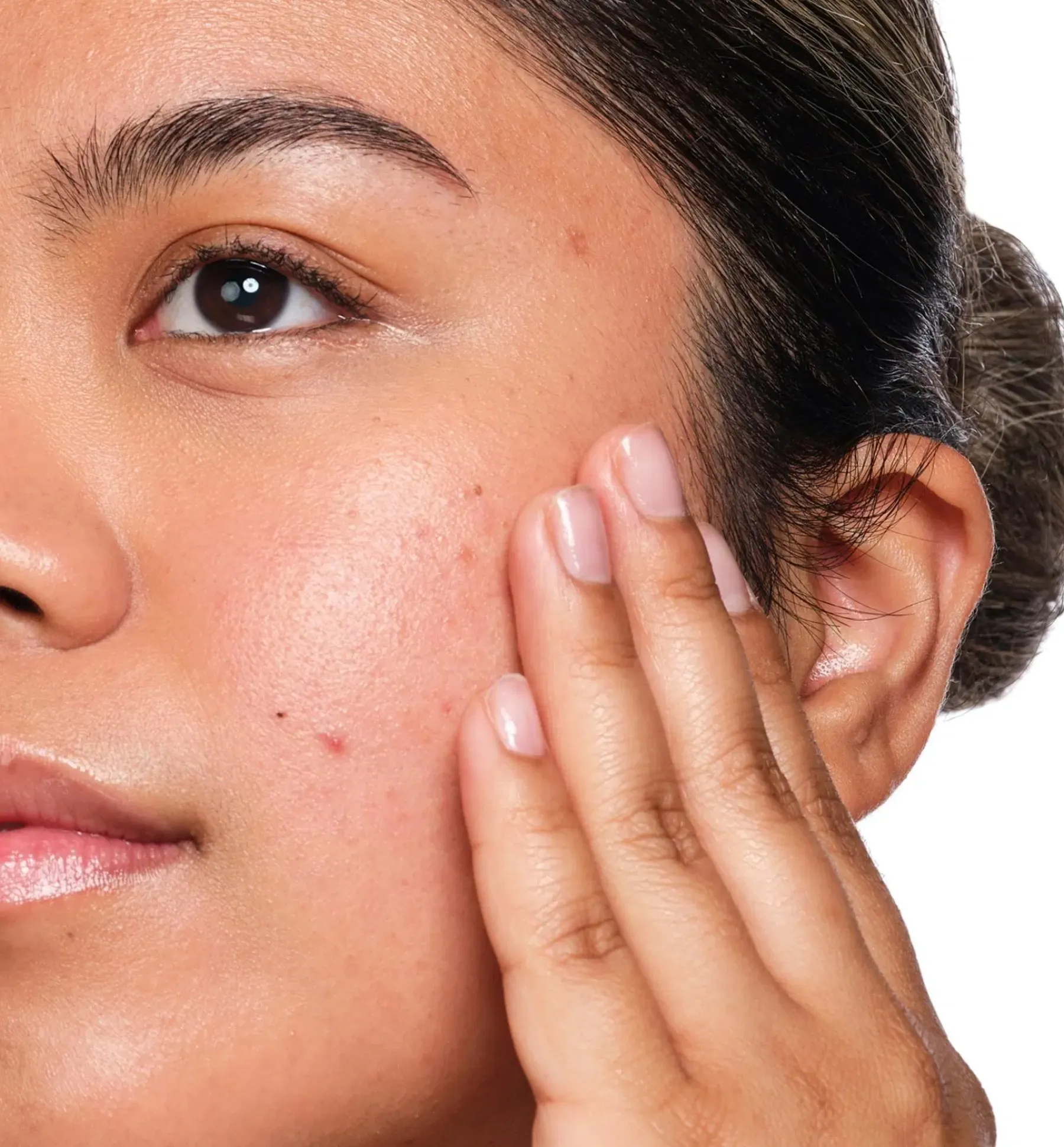 New Salicylic Acid 2% Solution liuos 30 ml Kasvojenhoito