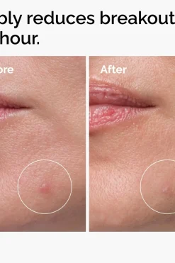 Clearance Sulfur 10% Powder-to-Cream Concentrate täsmätuote epäpuhtauksille 5g Kasvojenhoito